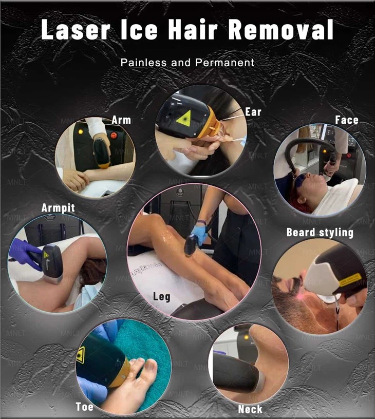 Big Power 1600w Laser Hair Removal Machine