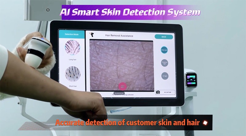 Diode Laser Hair Removal Machine – Professional, Efficient, And Customizable
